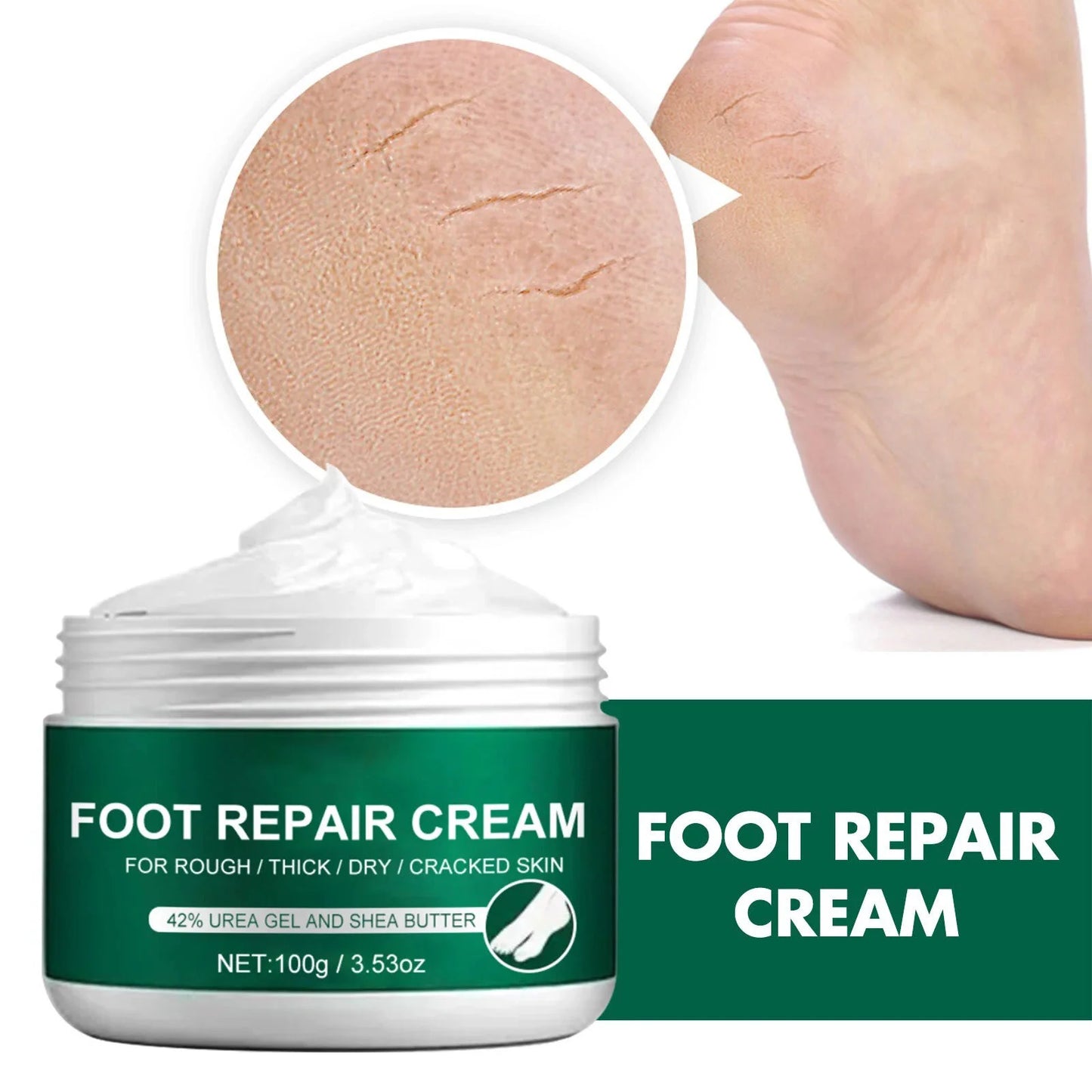 Cream for Dry Cracked Feet