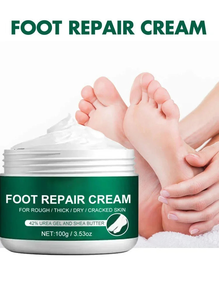 Cream for Dry Cracked Feet