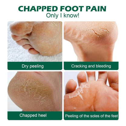 Cream for Dry Cracked Feet