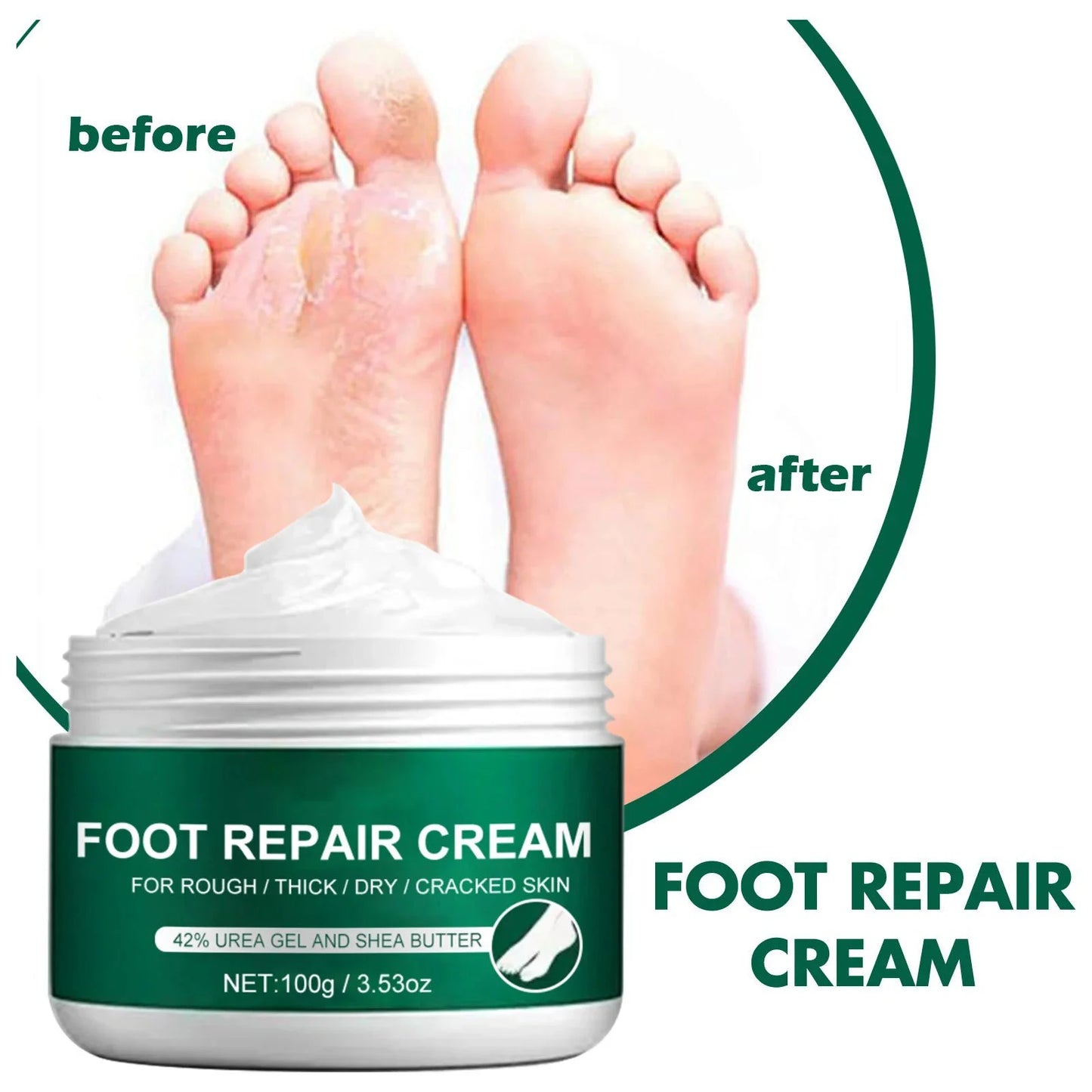 Cream for Dry Cracked Feet